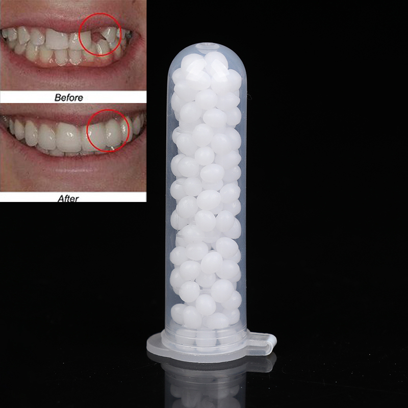 【K】1 confezione di kit per la  - Teeth Whitening Kit recensione e prezzo