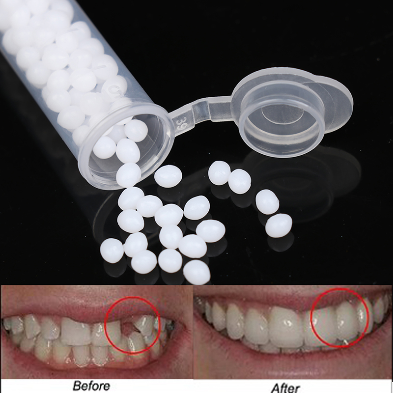【K】1 confezione di kit per la  - Teeth Whitening Kit recensione e prezzo